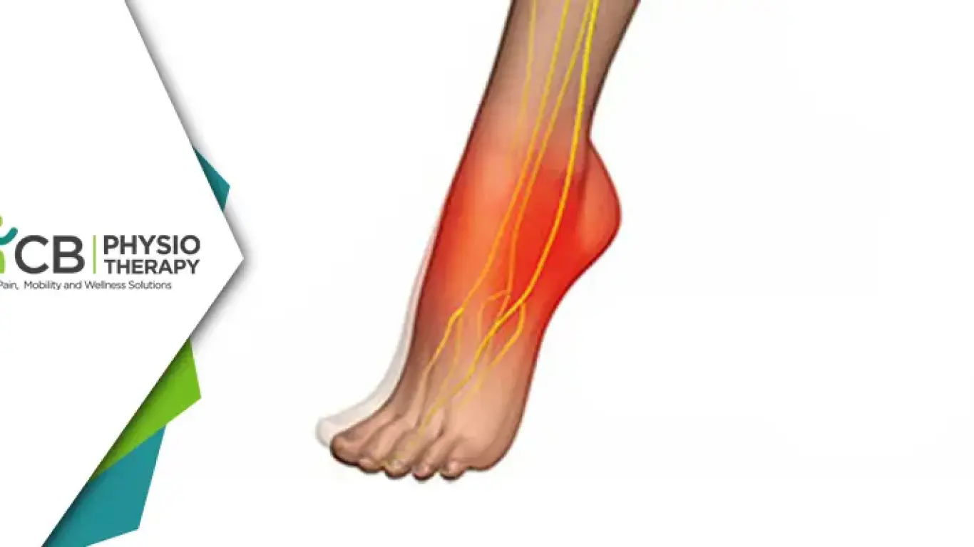 Managing Foot Drop In Spondylolisthesis | Effective Physiotherapy Techniques For Improved Mobility And Quality Of Life