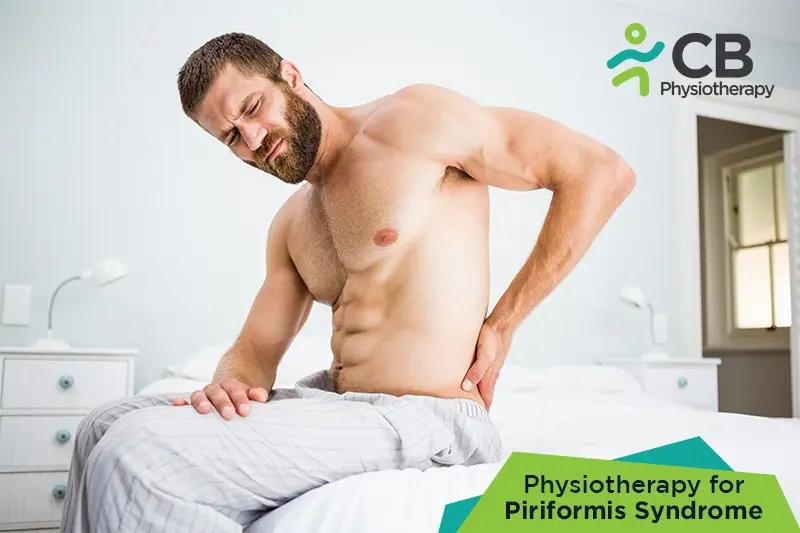 Piriformis Syndrome